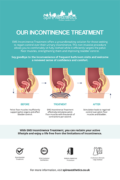 image to show how EMS treatment works for female urinary incontinence Blandford Camp