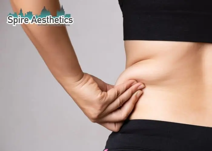 Image of woman pinching fat on their hips Blandford Camp. Fat Freezing treatment