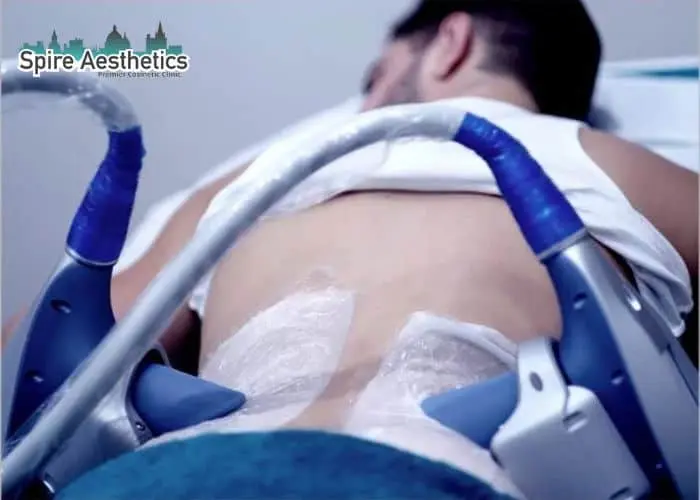 Man having fat freezing treatment done on love handles before a competitions Blandford Camp to create a sculpted look.